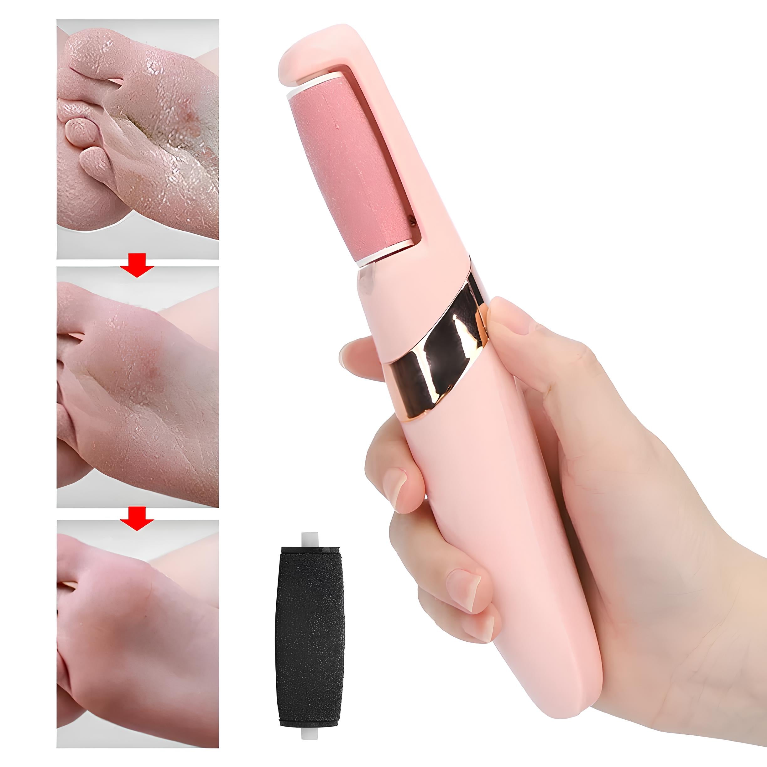 Removedor de Callos PediPerfect| Pedicura Sin Molestias ni Dolor 🦶💎