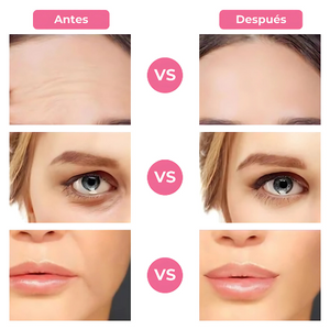 GlowLift| Tonifica, levanta y revitaliza tu rostro sin esfuerzo