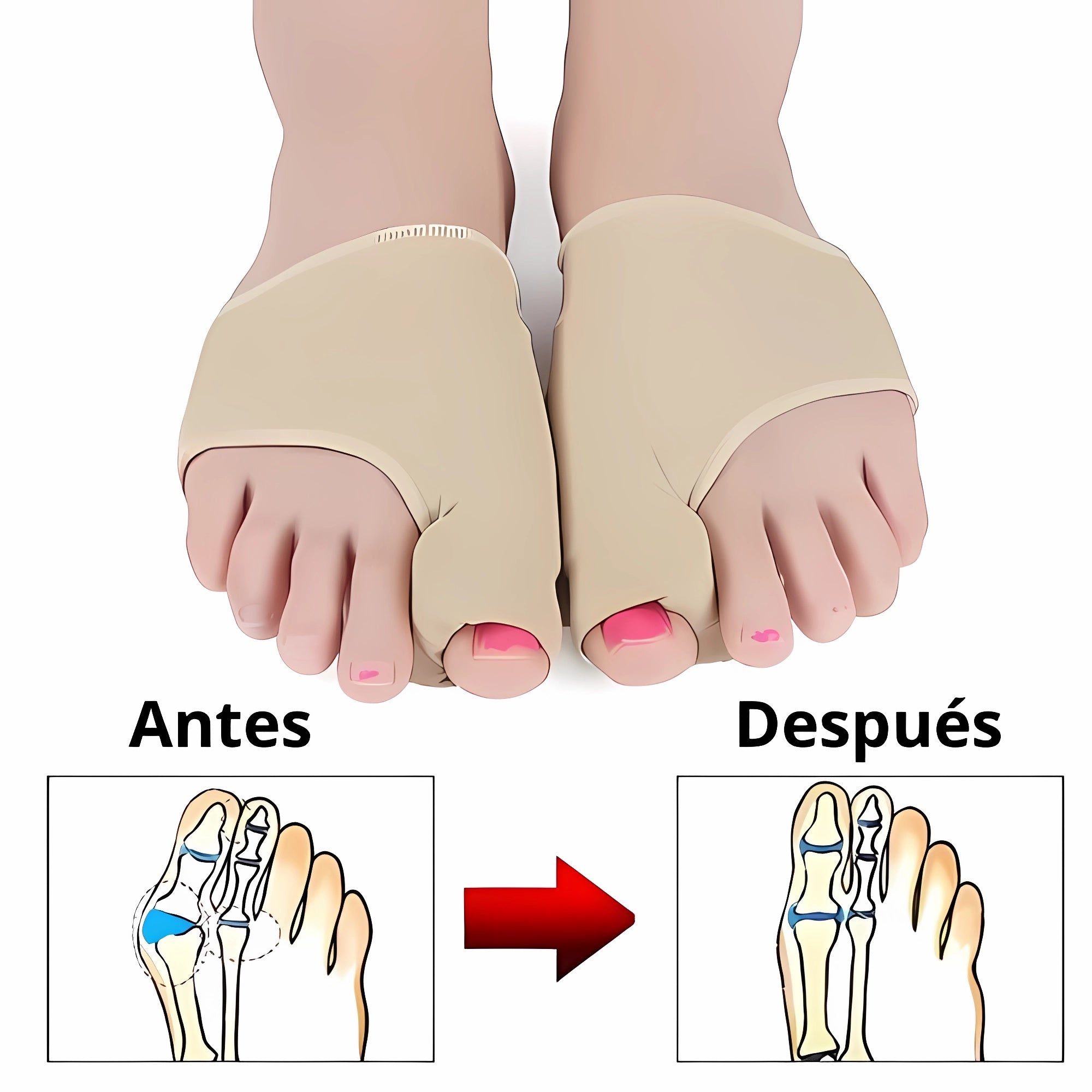Corrector de Juanetes PieRelax| Pies sin Dolor y Libres de Juanetes 🦶