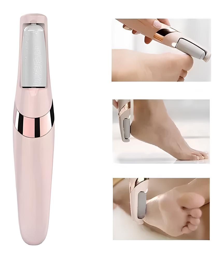 Removedor de Callos PediPerfect| Pedicura Sin Molestias ni Dolor 🦶💎