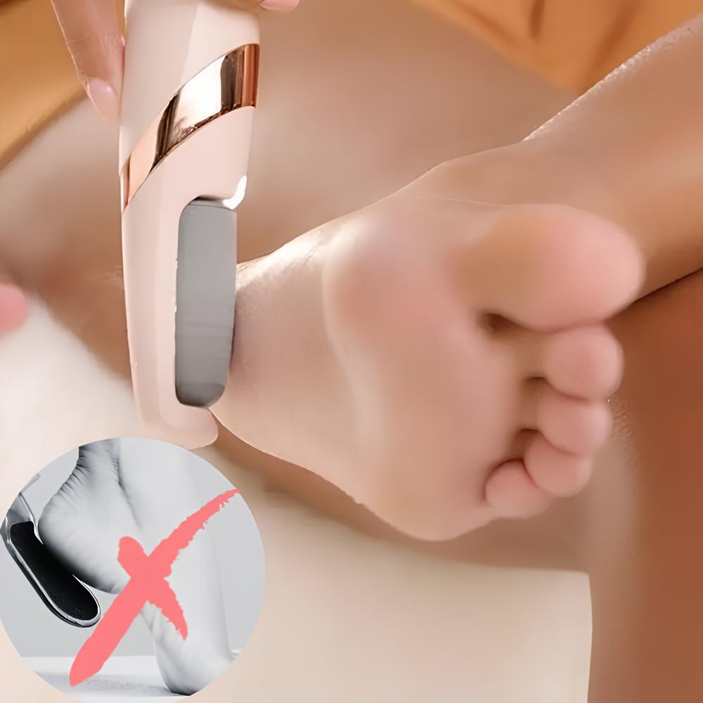 Removedor de Callos PediPerfect| Pedicura Sin Molestias ni Dolor 🦶💎