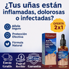 Pack 2x1 ReliefOil® | Aceite Natural para  para Cutículas Infectadas y Uñas Dañadas - Fortalece Uñas + Hidrata Cutículas + ENVÍO GRATIS