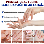 Pack 2x1 ReliefOil® | Aceite Natural para  para Cutículas Infectadas y Uñas Dañadas - Fortalece Uñas + Hidrata Cutículas + ENVÍO GRATIS