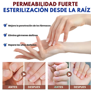 Pack 2x1 ReliefOil® | Aceite Natural para  para Cutículas Infectadas y Uñas Dañadas - Fortalece Uñas + Hidrata Cutículas + ENVÍO GRATIS