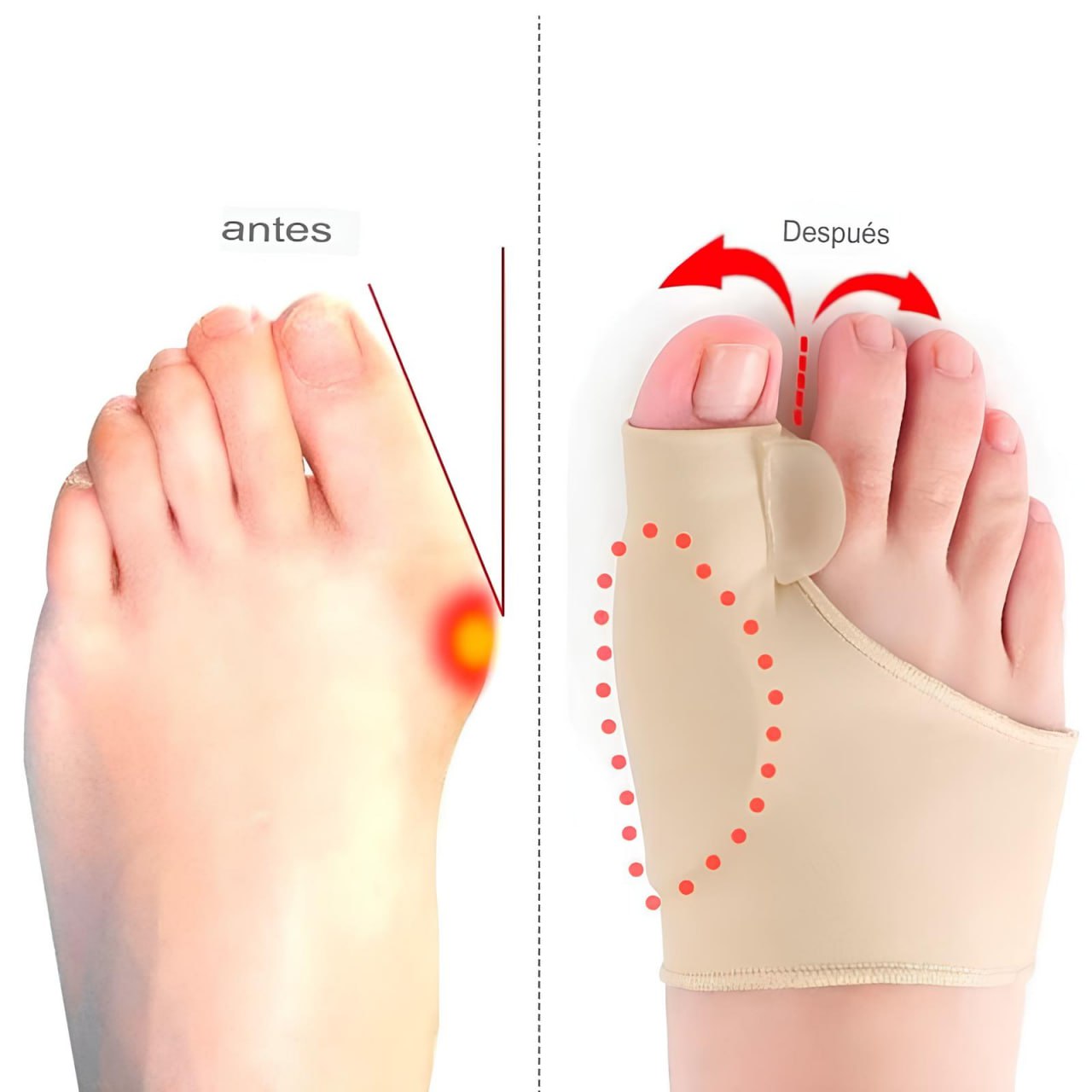 Corrector de Juanetes PieRelax| Pies sin Dolor y Libres de Juanetes 🦶