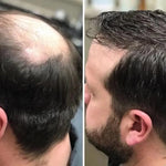 💥Tónico Capilar KingGinger| Nutre, fortalece y estimula el crecimiento capilar – Resultados en solo 1 semana + Envío gratis